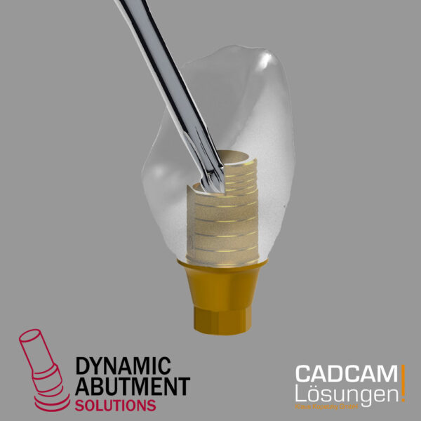 dynamic abutment solution titanbasis cadcam loesungen