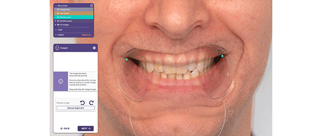 650 auf 450 exocad dentalcad galway automatically detected facial 123