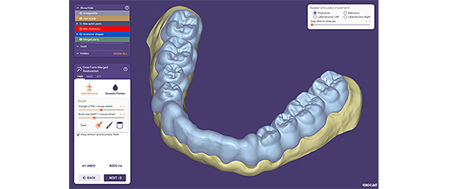 650 auf 450 exocad dentalcad galway bite splint include tooth